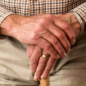 arthritic hands