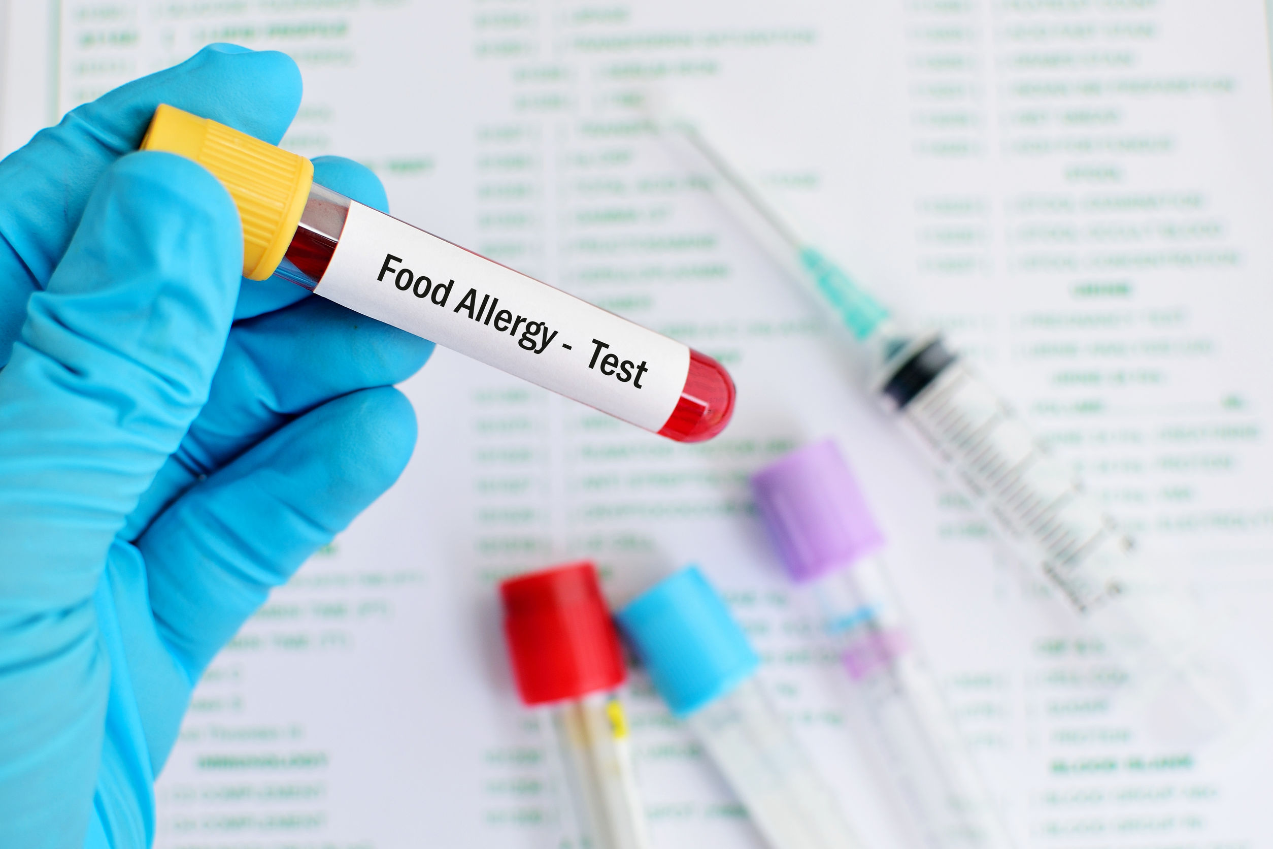 Blood for food allergy test